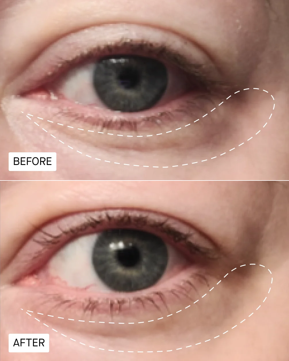 SPOILED CHILD H30 Fibroquin™ Advanced Firming Eye Cream  Fibroquin™ + Retinoid + Peptides 15ml/0.5 fl oz