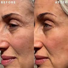 IL MAKIAGE - Power Redo Wrinkle Fix -Anti-Aging Blur & Smooth Wrinkle Filler 20ml