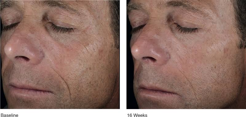 ALASTIN HydraTint Pro Mineral Sunscreen SPF 30